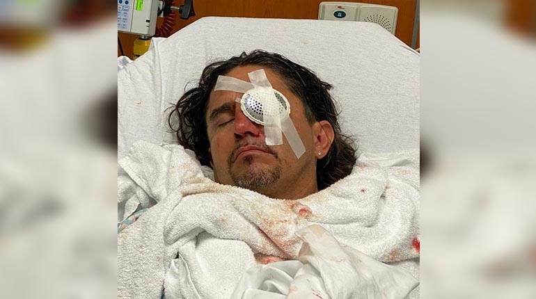 Exfutbolista Jaime Moreno, recuperado de su accidente, será comentarista de la Copa América 1 JAIME