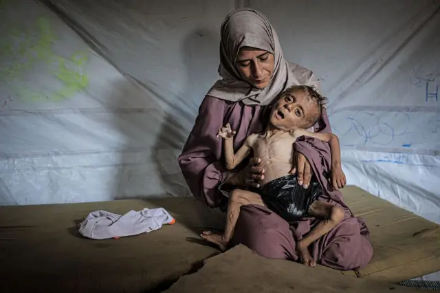 La historia de la foto de Hedaya y su bebé, una de las imágenes más impactantes de la hambruna en Gaza 2 Muhammad Zakariya Ayyoub al-Matouq mira a la cámara.
